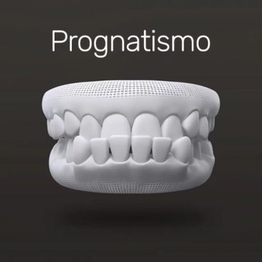 txt-invisalign-2 txt-invisalign-2