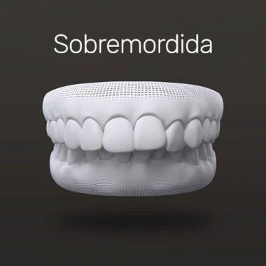 txt-invisalign-3 txt-invisalign-3