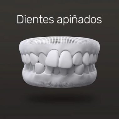 txt-invisalign-5 txt-invisalign-5