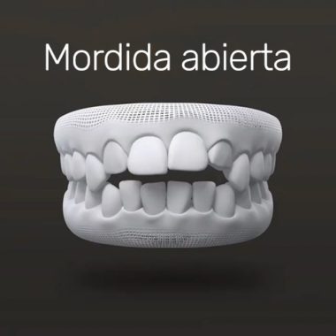 txt-invisalign-6 txt-invisalign-6
