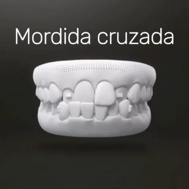 txt-invisalign-7 txt-invisalign-7