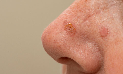 _shutterstock4418476991