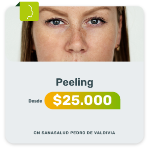 Promo Mar Abr 2026 - 2