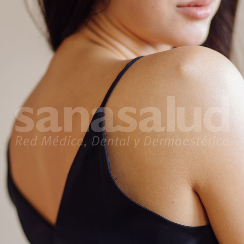 Microdermoabrasión Espalda